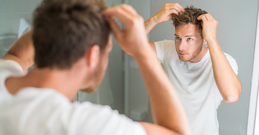 3 Reasons Why Your Hairline May Be Receding
